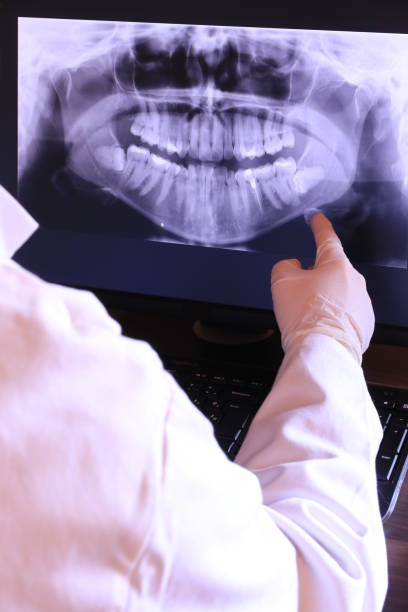 Best Broken or Chipped Tooth Repair in Martinsburg, WV