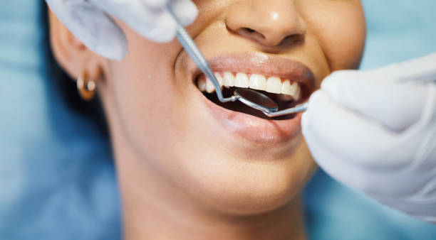 Best Emergency Wisdom Tooth Extraction in Martinsburg, WV